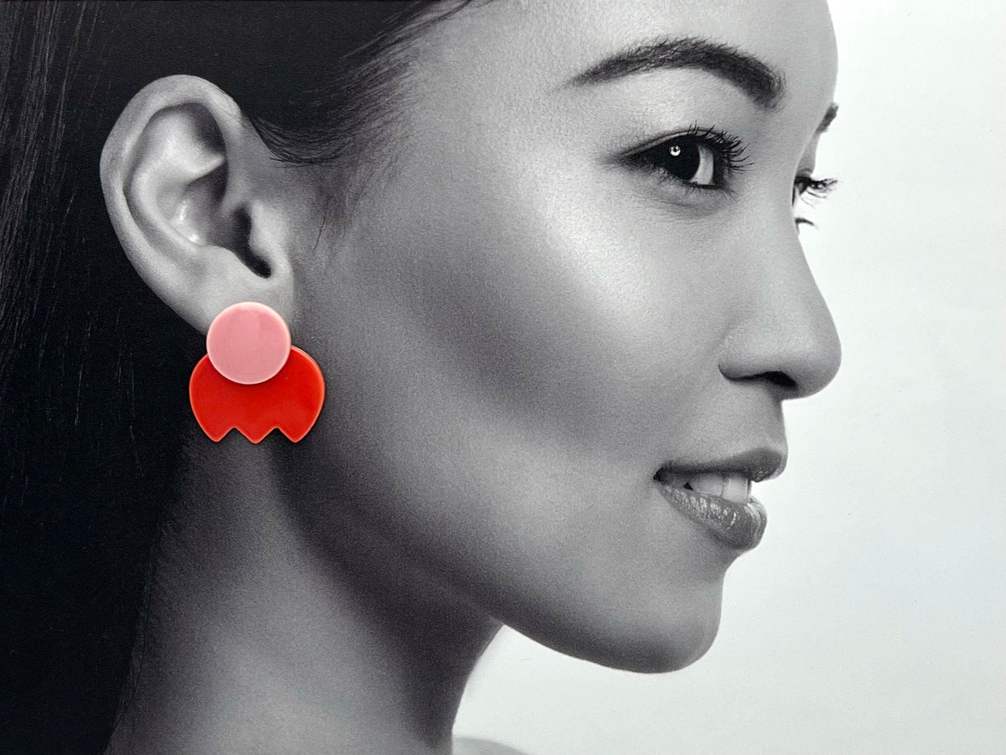 Défaut d'émaillage et de symétrie